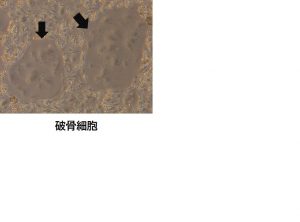 「発酵紅参エキス」の破骨細胞分化抑制作用を日本薬学会大会にて発表　〜　ナガセビューティケ…